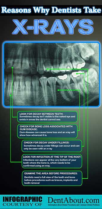 X-rays report