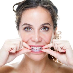 woman putting in clear aligners